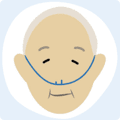 Diagram of patient receiving oxygen therapy Diagram of patient receiving oxygen therapy